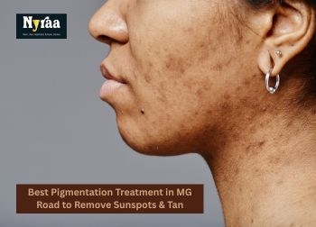 Best Pigmentation Treatment in MG Road to Remove Sunspots  Tan