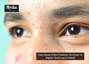 Stay Ahead of Skin Problems The Power of Regular Checkups in Hebbal