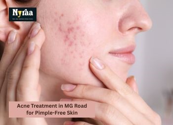Acne Treatment in MG Road for Pimple Free Skin