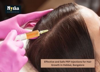 Effective and Safe PRP Injections for Hair Growth in Hebbal Bangalore