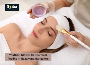 Youthful Glow with Chemical Peeling in Nagawara Bangalore