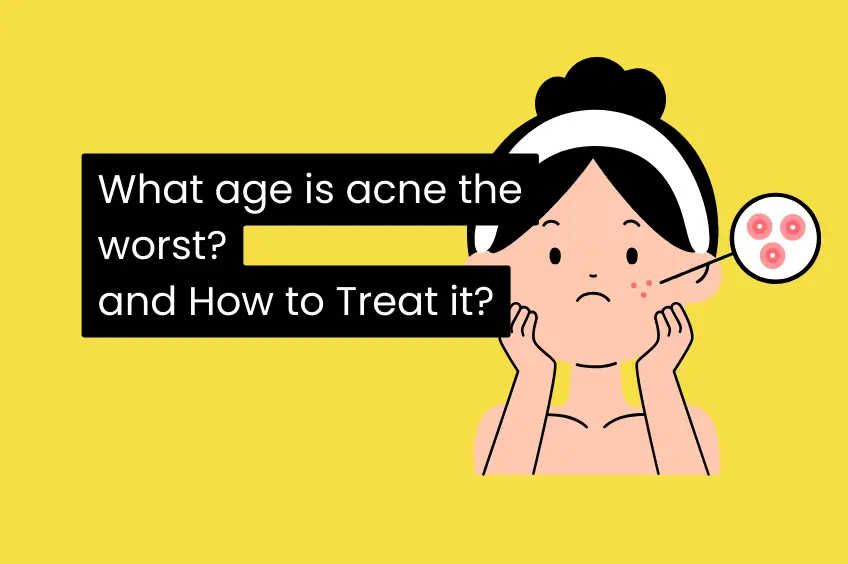 What age is acne the worst