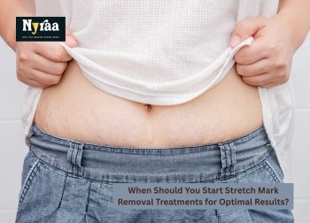 When Should You Start Stretch Mark Removal Treatments for Optimal Results