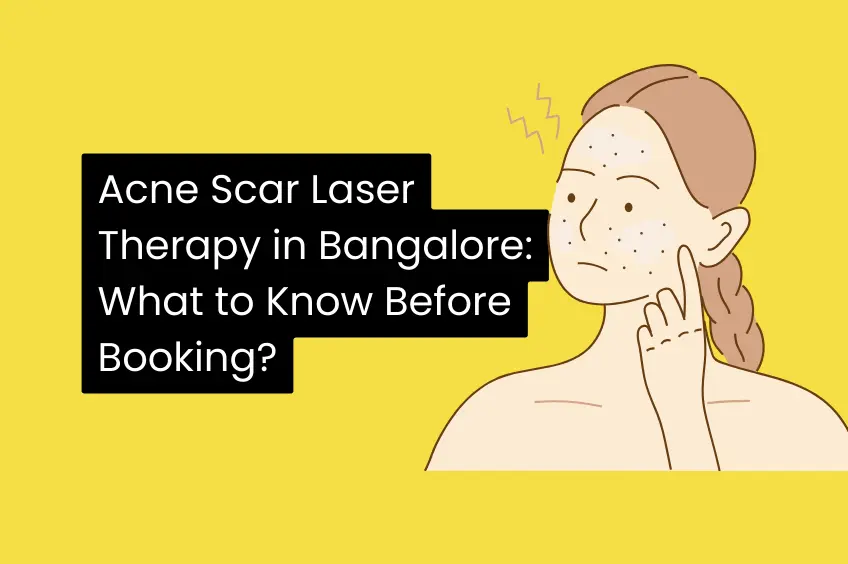 Acne Scar Laser Therapy in Bangalore What to Know Before Booking