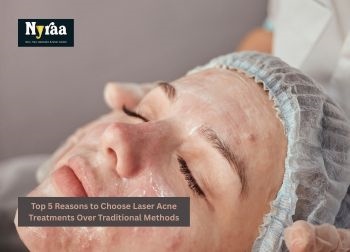 Top  Reasons to Choose Laser Acne Treatments Over Traditional Methods