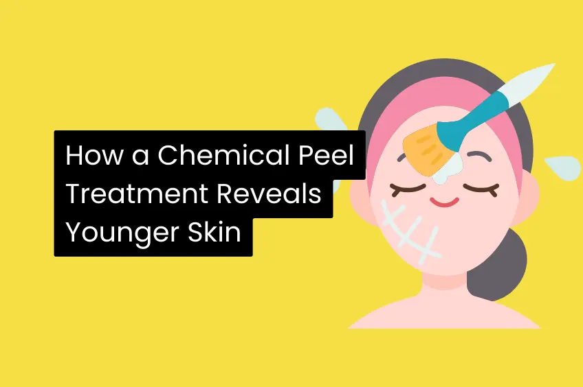 How a Chemical Peel Treatment Reveals Younger Skin