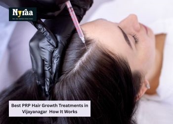 Best PRP Hair Growth Treatments in Vijayanagar  How It Works