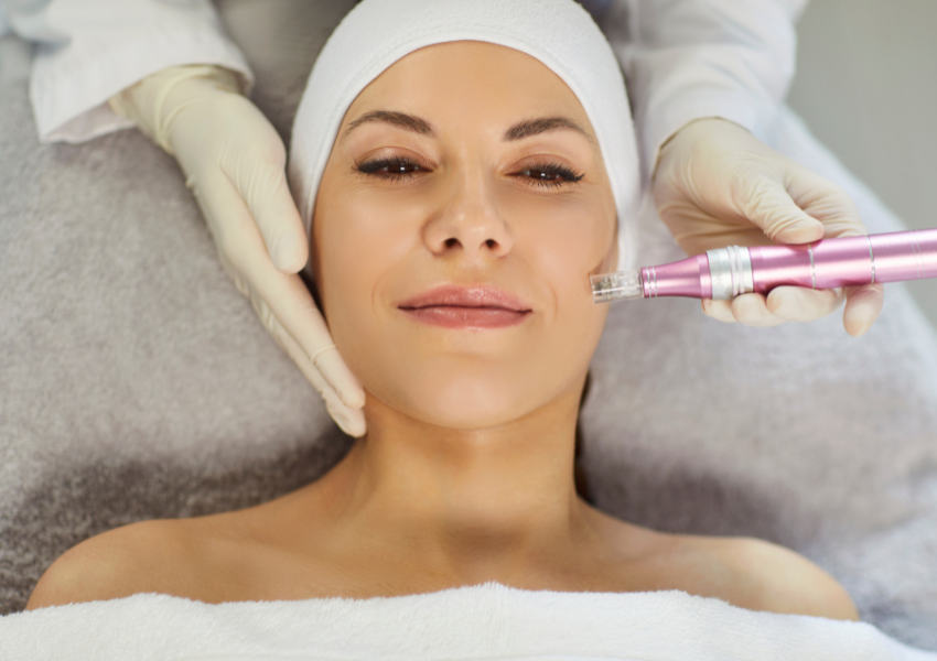PDRN Microneedling Treatment